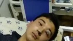 В Самарканде десятиклассник выпал со второго этажа школы