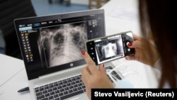 Snimak pluća oboljelog od COVID-19, Ilustrativna fotografija