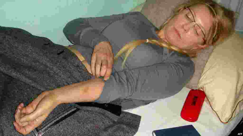 Бывшая премьер-министр Украины Юлия Тимошенко показывает синяк на руке 25 апреля в Качановской женской исправительной колонии в Харькове. Тимошенко, осужденная в октябре 2011 года на семь лет тюремного заключения, обратилась с жалобой на то, что трое мужчин накинули на нее простыню и ударили ее в живот. (AFP/&quot;Украинская правда&quot;)