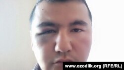 Учитель из Чиракчинского района Шохнур Оккузиев после избиения родственниками одного из старшеклассников был госпитализирован в нейрохирургическое отделение Кашкадарьинского областного многопрофильного медицинского центра.