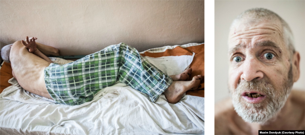 Олександр, 54 роки. Новотроїцький протитуберкульозний диспансер, липень 2011 року. Розповідь лікарів: &laquo;Був жорстоко побитий, втратив пам&rsquo;ять. Ми не змогли знайти родичів. Багато галасує, поводиться агресивно. Коли закінчить курс лікування, його направлять до психлікарні&raquo;. Розповідь хворого: &laquo;Мене звати Олександр Бухарьов. Я народився 1957 року і зараз живу в Херсоні. Я одружений, маю двох дітей. Туберкульоз залікували, тепер направляють до психіатричної лікарні для встановлення діагнозу&raquo;.