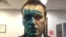 Russian opposition leader Aleksei Navalny says his eyesight might be impaired after his face was splashed with a green "zelyonka" antiseptic. (file photo)