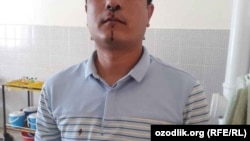 Специалист отдела по земельным ресурсам и государственному кадастру хокимията Гузарского района Кашкадарьинской области Фахриддин Курбанов утверждает, что замхокима сломал ему нос.