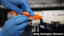 Fotografi ilustruese nga arkivi.