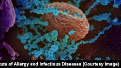 Particule de coronavirus, în albastru, surprinse de microscopul electronic, pe o cultură de laborator