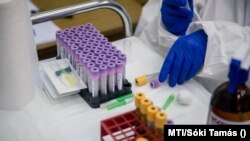 Mintavételhez használt kémcsövek a Mohácsi Kórházban 2020. május 12-én.