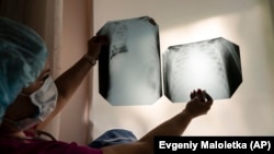 За весь період епідемії в Україні підтверджено 17 858 випадків COVID-19, з них 4906 людей вже одужали, 497 – померли