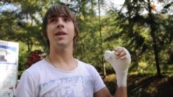 Foča: Prva replantacija šake u bolnici