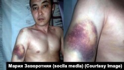 Содержащийся в СИЗО №1 Бишкека Эмилбек Кимсанов демонстрирует следы, якобы полученные в результате избиений. Фото взято с Фейсбук-страницы его супруги.